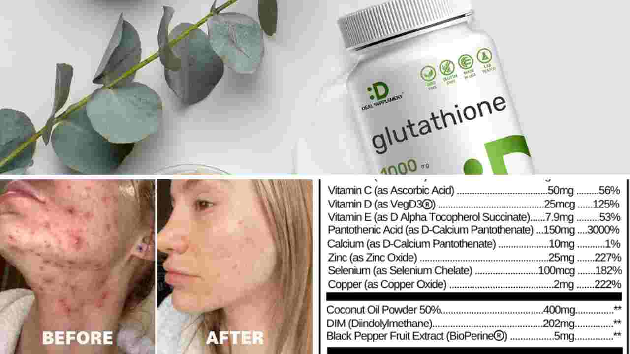 6 Vitamins For Acne: Battle Blemishes and Shine Bright!